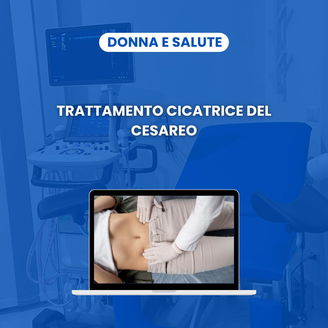 TRATTAMENTO CICATRICE DEL CESAREO